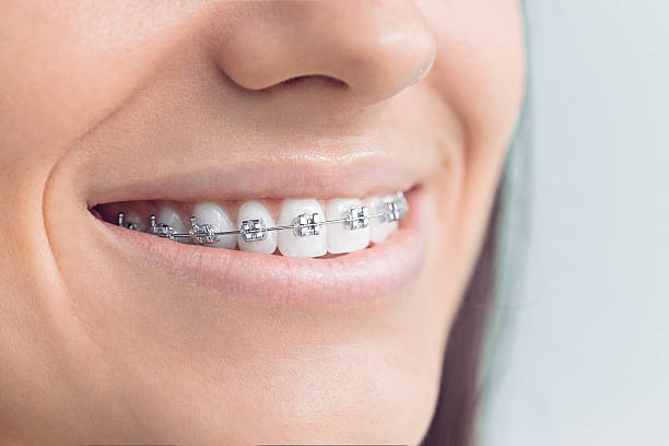 Best Dental Implants  in Munfordville, KY